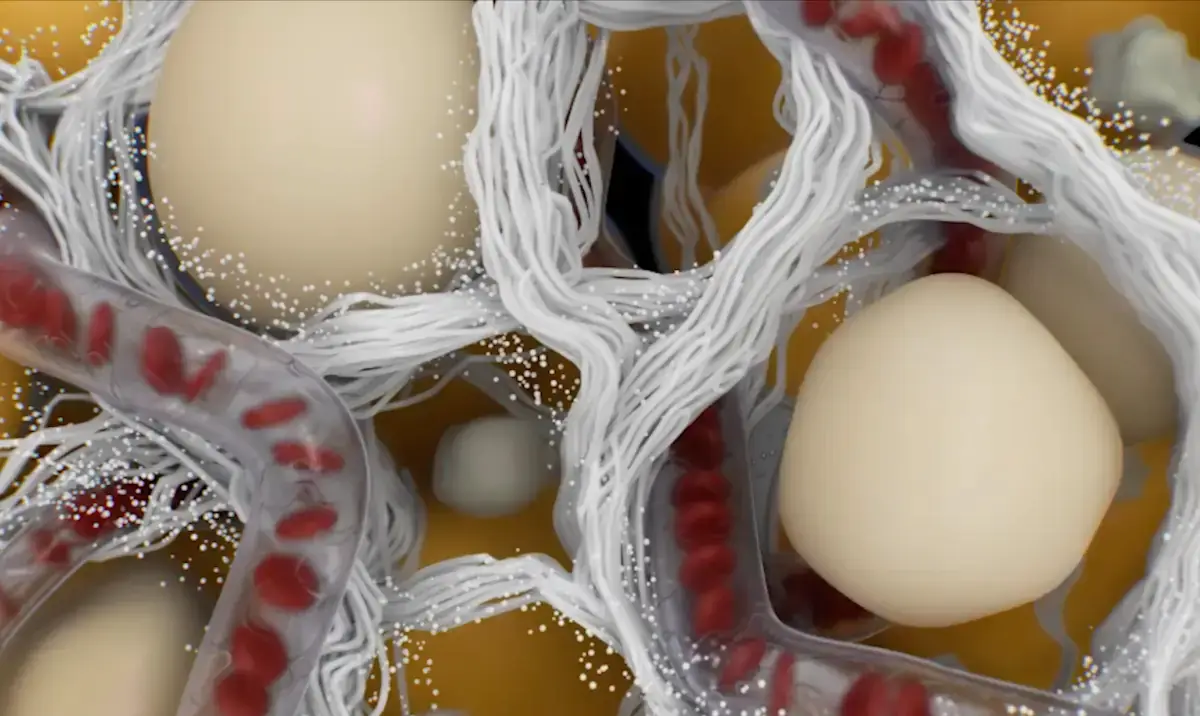 alloClae Structural Adipose Filler