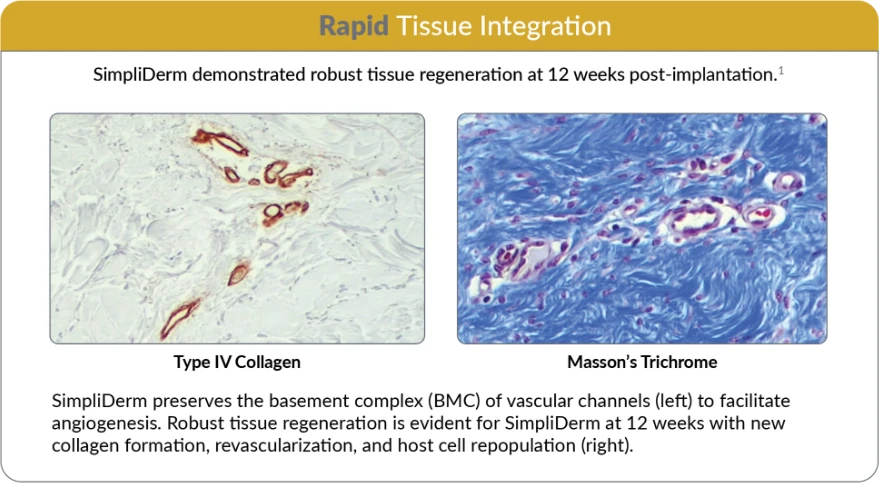 SimpliDerm ADM Rapid Tissue Integration Chart
