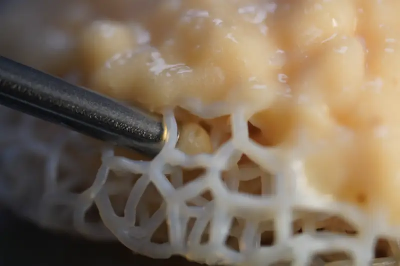 GenesisTissue regenerative breast tissue scaffold